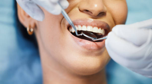 Best Emergency Treatment for Dental Infections or Abscesses in West Yellowstone, MT